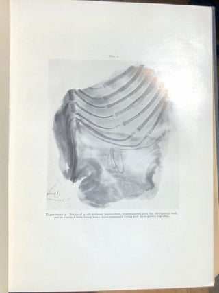 Transactions of the New York Surgical Society Volume II 1913